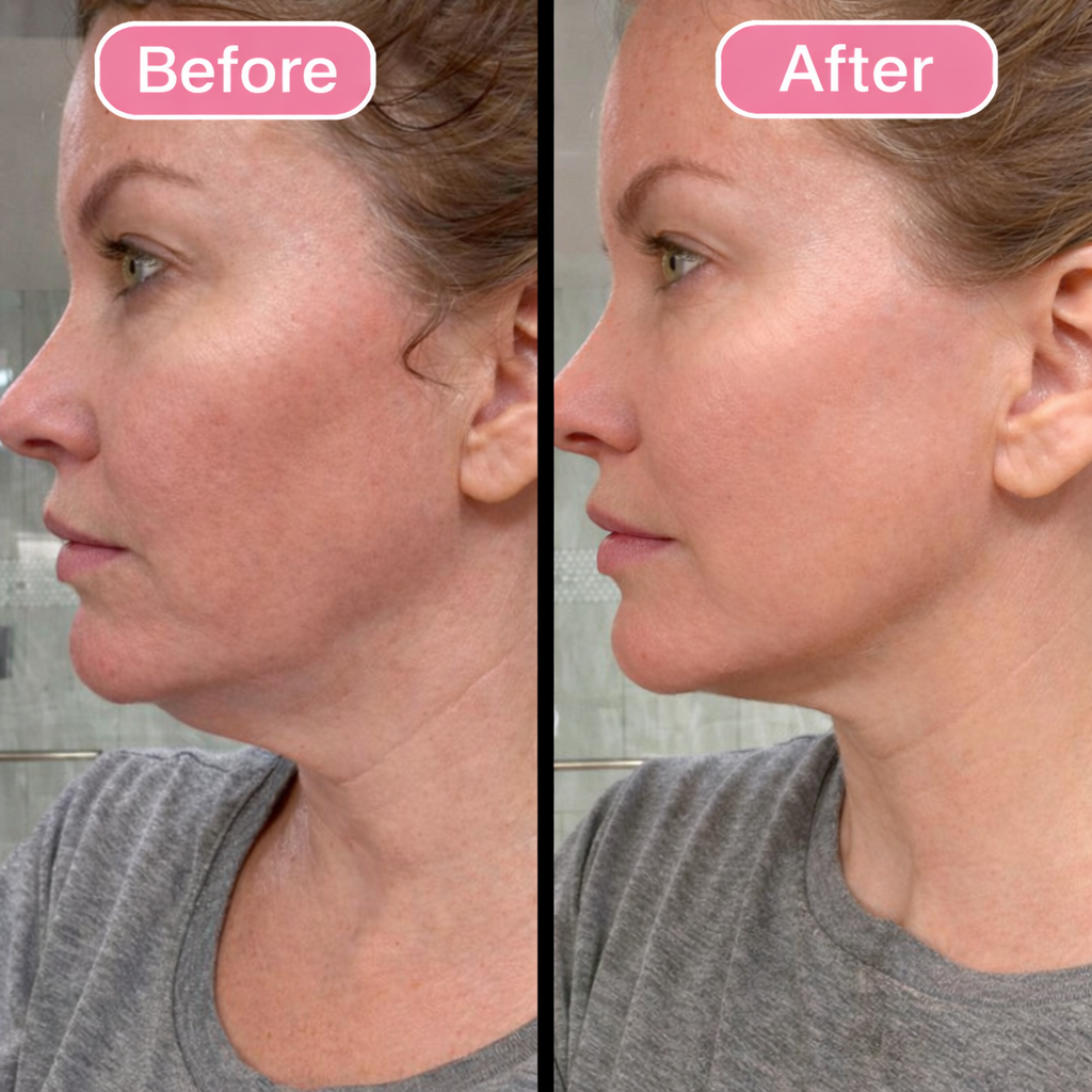 LymphLift™ Brush