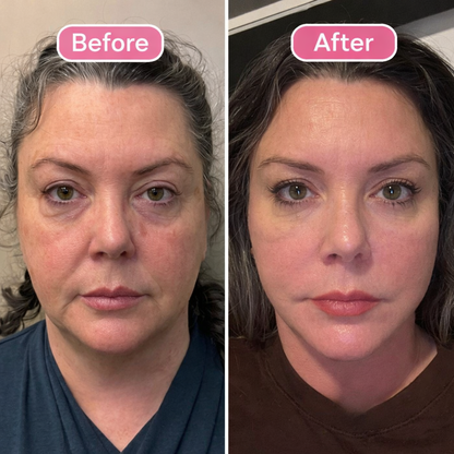 LymphLift™ Brush