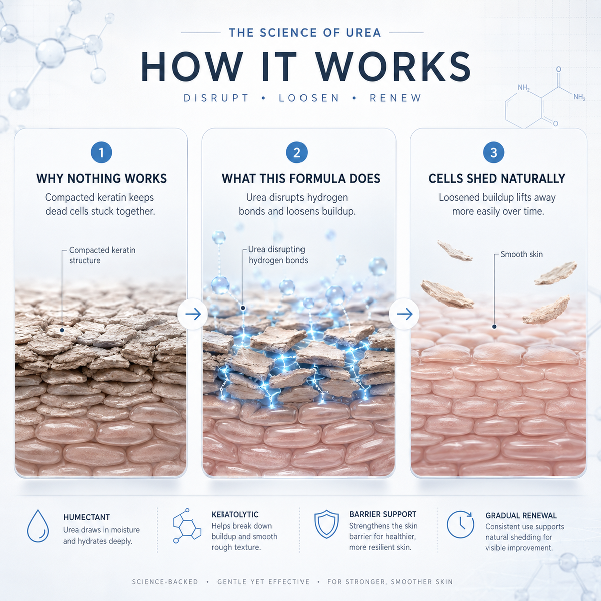 Aluvia™ Advanced Keratolytic Cream For Rough, Raised Seborrheic Keratoses