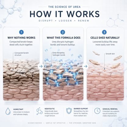 Aluvia™ Advanced Keratolytic Cream For Rough, Raised Seborrheic Keratoses