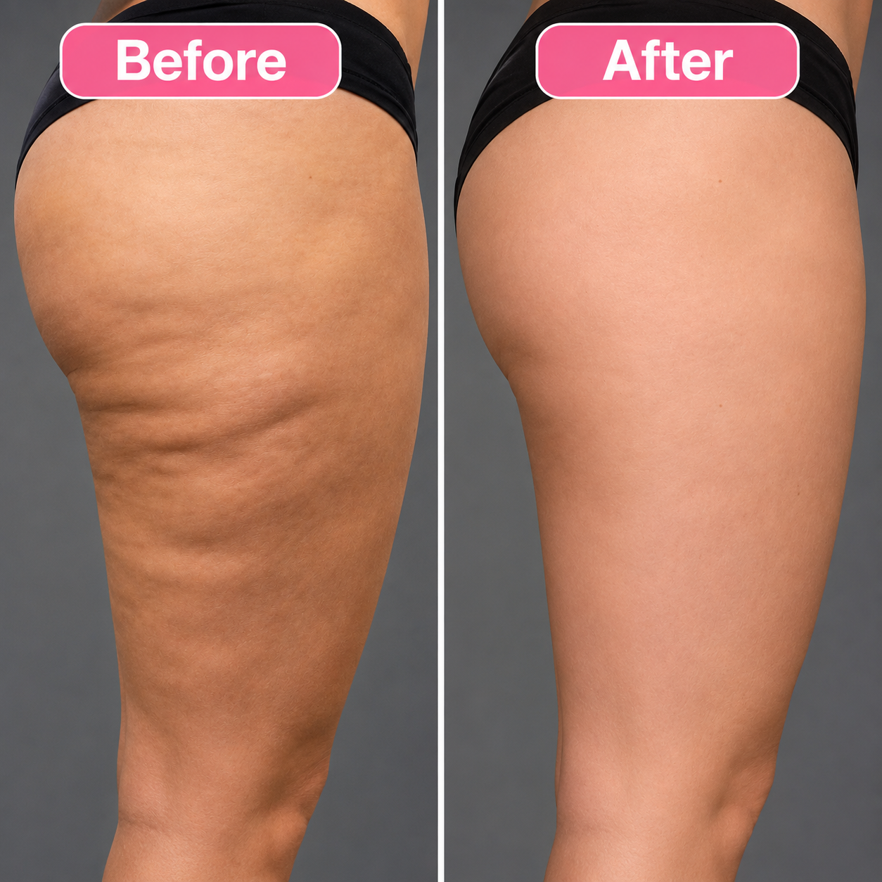 Lymphatic Drainage Drops